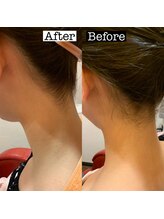 コンソラトゥールベール マインドサイトウ(consolateur belle mind saito)/before・after