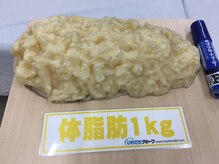湘南健康カイロプラクティック 伊勢原店/脂肪1ｋｇ