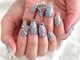 エスネイル 名古屋店(es NAIL)の写真/【深爪や折れてしまった爪、亀裂もお任せください】芸能人ご用達、ブログでも大人気の「Ellenail」★