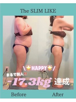 スリムライク 鳥取店(The SLIM LIKE)/痩身ビフォーアフター