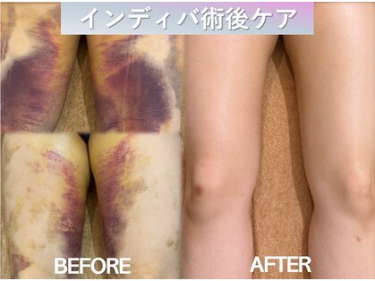 ラディアント(Radiant)の写真