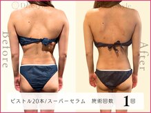 ココア整体 岐阜店(cocoa整体)/最新痩身マシン/脂肪燃焼リンパ