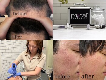 リベルテ(Liberte)