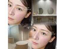 【デザイン豊富】お客様のお目元に合ったまつげデザインを提案♪