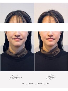 ウル 宇多津店(URU)/立体小顔矯正