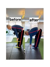 リライズ(re.RAIZE)/70代男性　腰痛