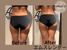 アムール 麻布十番(Amour)/エムスレンダー