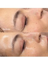 ルミナス(Luminous)/ララピール