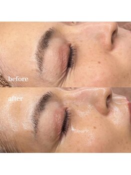 ルミナス(Luminous)/ララピール