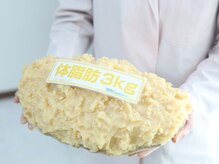 ジュピテール/脂肪模型