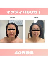PNFインディバサロン/インディバ６０分