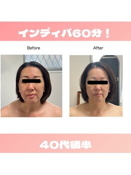 PNFインディバサロン/インディバ60分