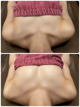 ロココ 岐阜店(Rococo)/痩せ型さんも諦めないで!