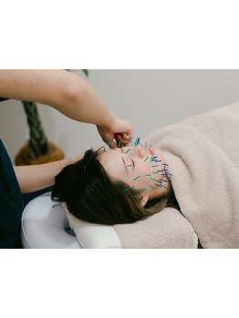 小顔になりたい