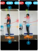 若松整体院若林区院/骨盤矯正ビフォーアフター☆