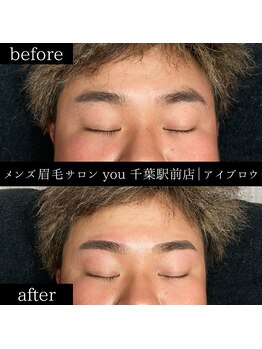ユー 千葉駅前店(you)/ビフォ-アフター写真
