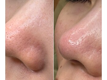 サイ(Sai)/テカリと艶の違い