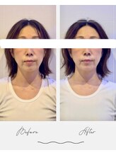 ウル 宇多津店(URU)/立体小顔矯正