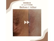 サロン ド ブリオン(Salon de Brillant)の雰囲気(施術+ホームケアを半年間続けられた結果◎黒ずみたるみが綺麗に)