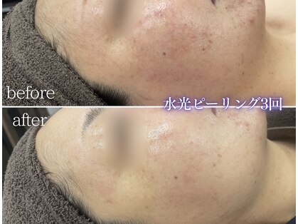 ミレット(Miretto)の写真