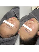 アマールシ 円山店(Amarsi)/plawave 