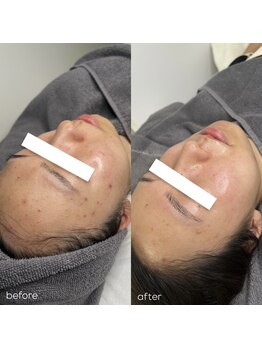 アマールシ 円山店(Amarsi)/plawave 