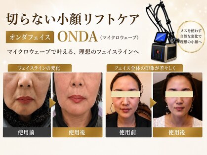 プラス ミー(+Me)の写真