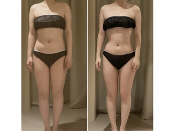 ドゥ ボーテ(de beaute)の写真/全身の脂肪を分解★運動や食事制限、痛みが苦手な方にもおすすめ!お気軽にご相談ください◎