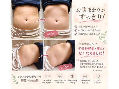 スーリヤ アーカーシャ(surya akasah)の写真