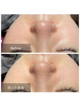 グレイス(Grace)/翌朝のお肌にビックリ！