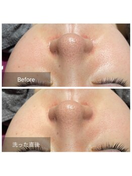 グレイス(Grace)/翌朝のお肌にビックリ！