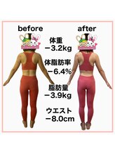おいけ美容整体院 桐生院/産後ダイエット！