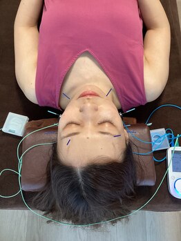 ハリファ鍼灸院 横浜関内院(HariFa鍼灸院)/美容施術/美容鍼