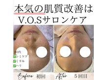 サロン ド ボーテ ラーンジュ 岐阜店(salon de beaut'e L'ange)/本気の肌改善毛穴、ニキビ、しみ