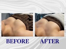 ザモア 福岡天神(THE MORE)/【症例 Before After】