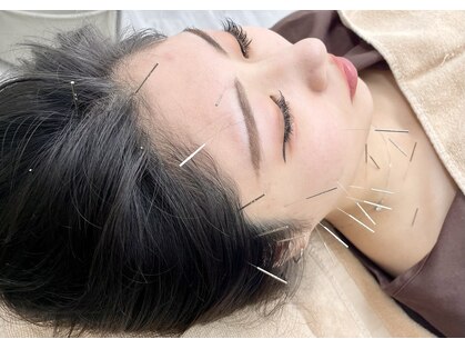 鍼灸ハリカラの写真