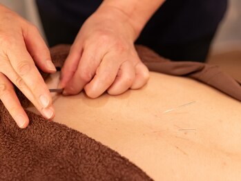 悠健堂の写真/痛み/不調を放っておかない!初心者でも安心の鍼灸と骨盤調整。リピーターが多い小規模プライベートサロン☆