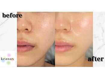 ケアナクス 恵比寿本店(keanax)