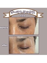 ビーマジック(美magic)/サーマトリックス