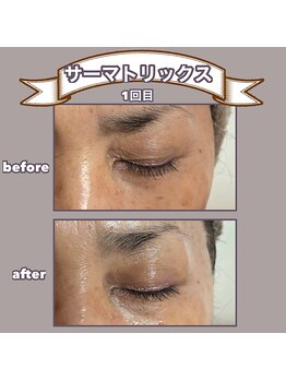 ビーマジック(美magic)/サーマトリックス