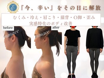 エマーチェ 自由が丘(emmace)