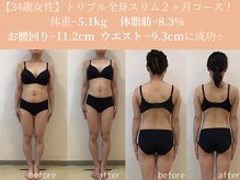 エターナルフレーム(Eternal Flame)/34歳トリプル全身痩身２ヶ月