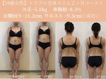 エターナルフレーム(Eternal Flame)/34歳トリプル全身痩身２ヶ月