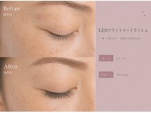 ミューズ(MUSE)/LEDラッシュ｜ナチュラル 80本