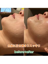 ラポール 池袋東口(Rapport)/小顔　ひきしめ
