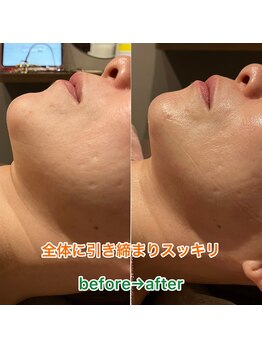 ラポール 池袋東口(Rapport)/小顔　ひきしめ