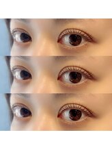 アイリス(eyeris)/