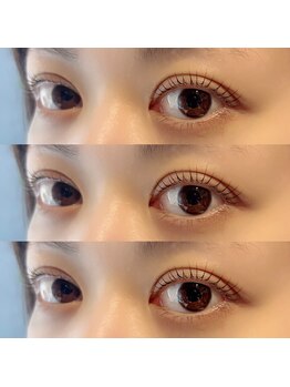 アイリス(eyeris)/