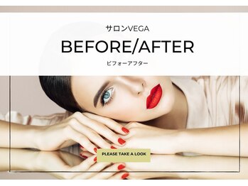 ベガ(Vega)/ BeforeAfter
