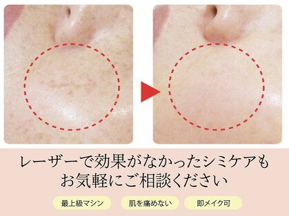 ビアンビューティー(Vi-an Beauty)の写真